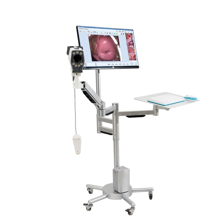 Gynecology Beautiful Video Colposcope for Vagina Digital Video Colposcope