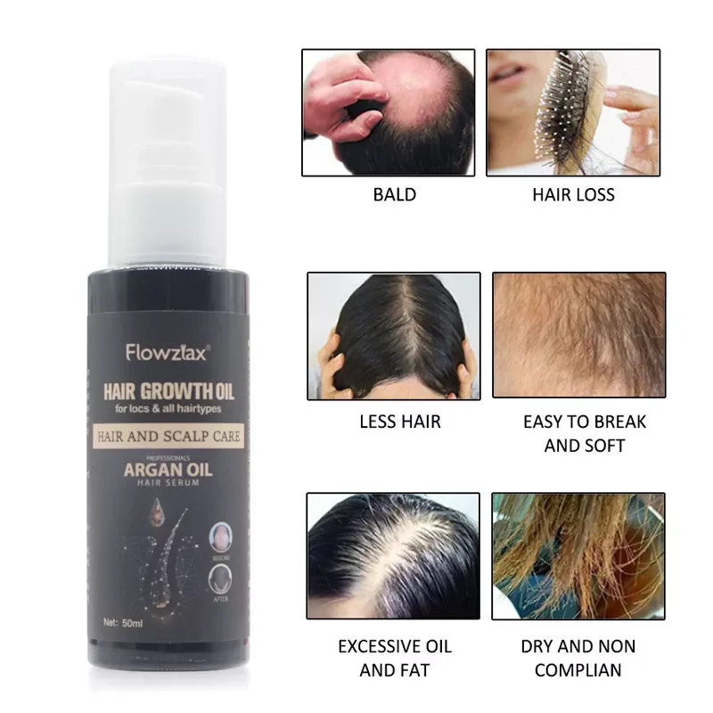 Private Label Natural Organic Vegan Treatment for Baldness Hair Growth Essential Oil Herbal Anti-Hair Loss Hair Growth Oil