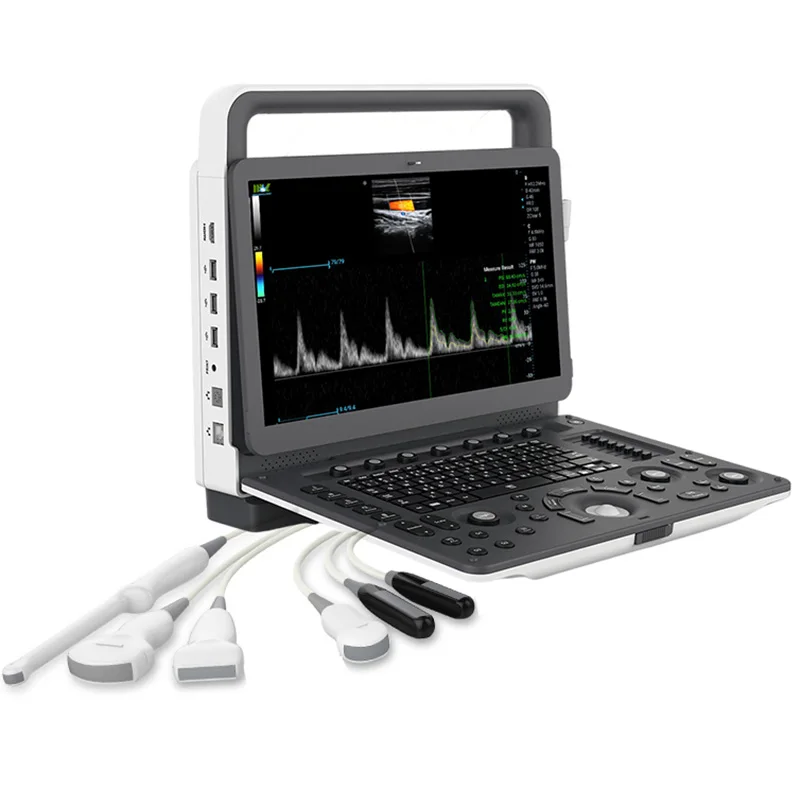 Медицинская ультразвуковая машина нового типа с выпуклым зондом