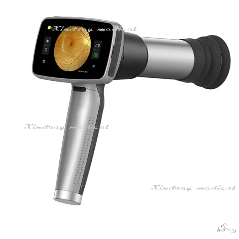 Hfc-02 Ophthalmic Equipment Retinal Non Mydriatic Handheld Portable Eye Fundus Camera