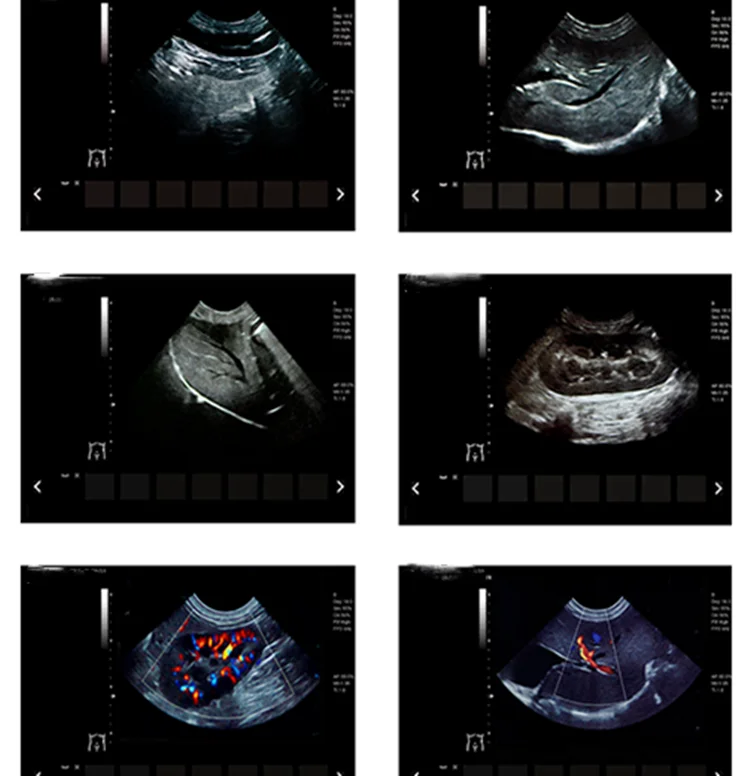 vet ultrasound machine (4).png