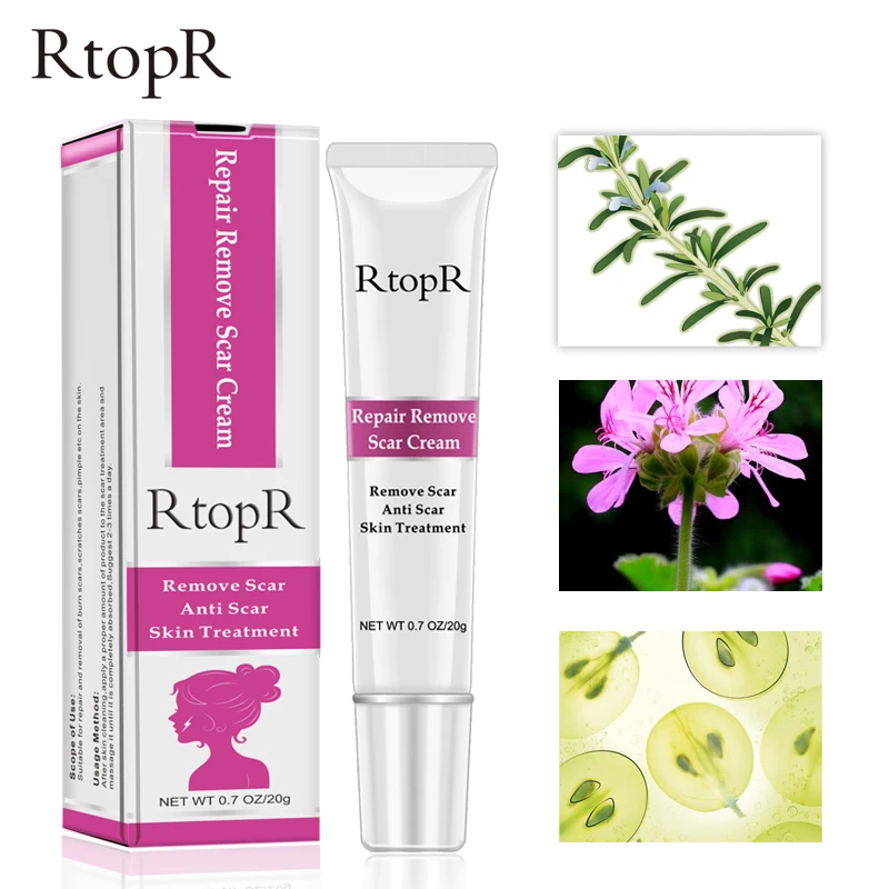 Good effect  removal scar anti scar  Acne Scar Removal Cream skin care treatment