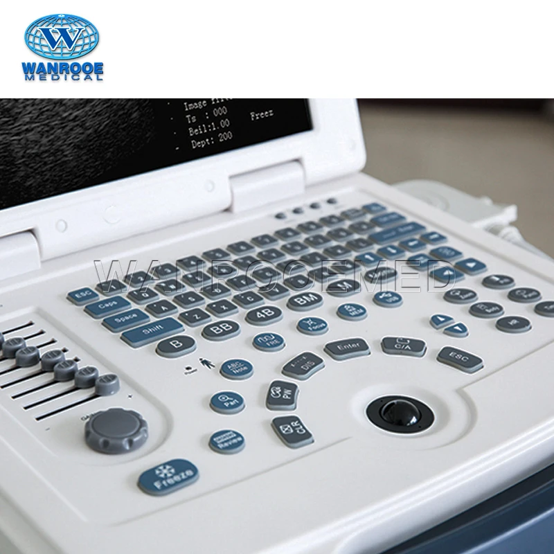 US580 Medical Mobile Laptop BW Diagnostic Ultrasound Scanner Machine Price