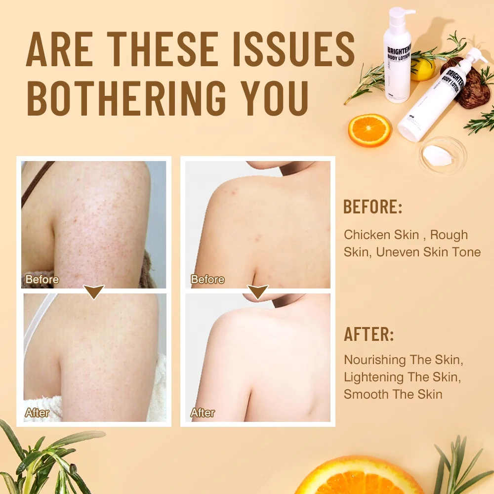 Private Label Arbutin Vitamin C Skin Brightening Lighten Dark Spots Niacinamide Kojic Acid Whitening Body Lotion