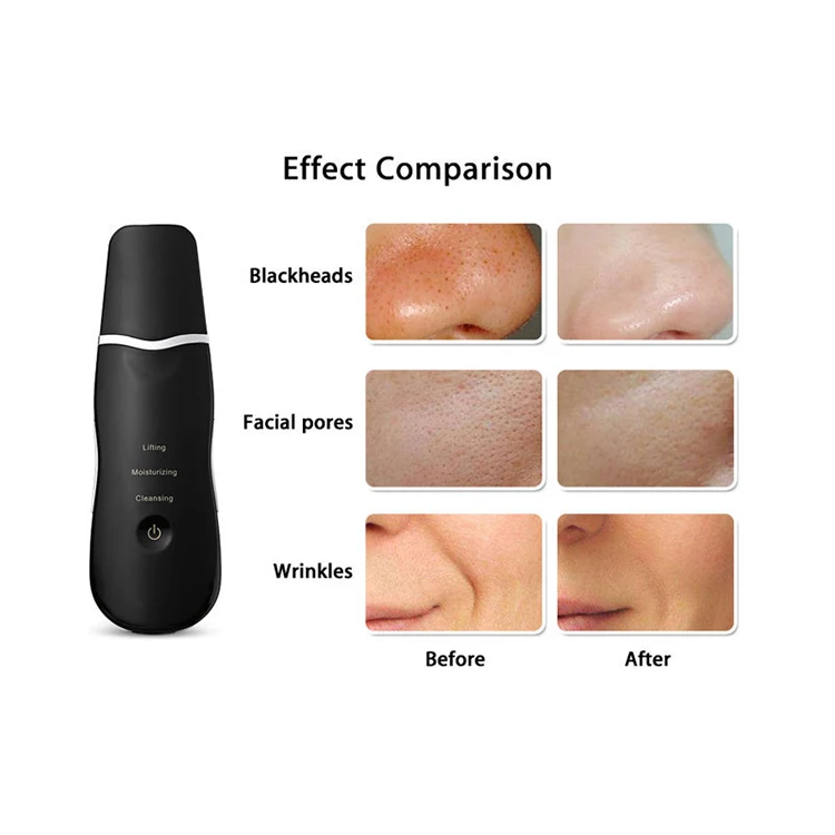 Spatula Ultrasonic Skin Scrubber Spatula 4 Modes Facial Scrubber