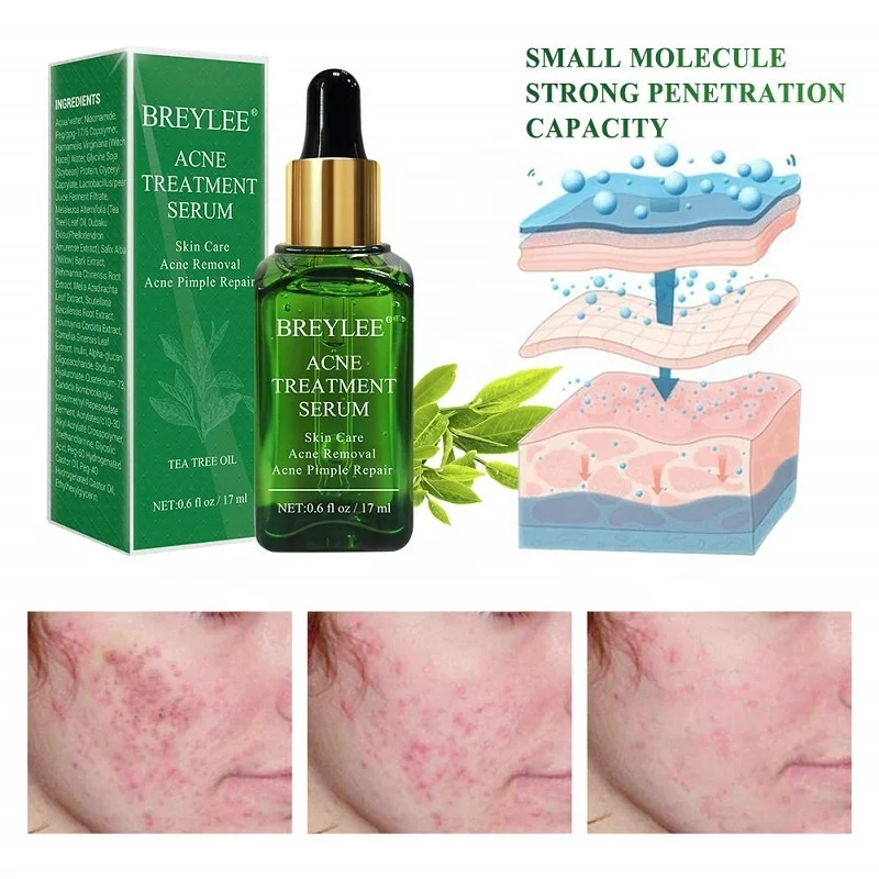 BREYLEE 17ml Herbal Organic Skin Care Serum Acne Treatment Essence Liquid Shrink Pores Repair Serum