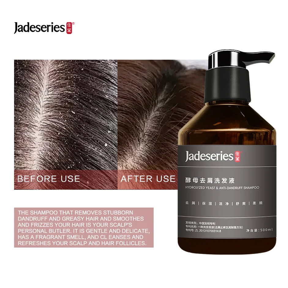 Hot Selling Own Brand Anti-Dandruff Hair Care Shampoo 500ml Volume Herbal Natural Formula Oil Control Damaged Repair Smoothing