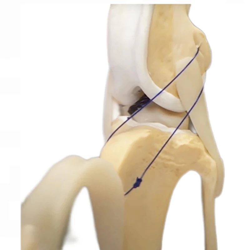 Veterinary Orthopedic Implants Canine Cruciate Ligament  Animal Dog Artificial Ligament