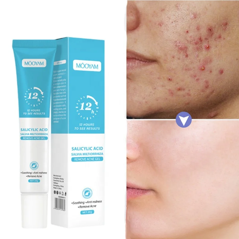 private label quick anti acne salicylic acid face gel pimples scars treatment herbal acne removal gel