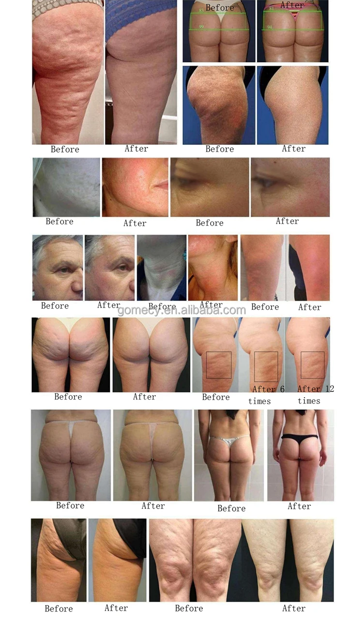 Rotary RF Slim 1 (8).jpg