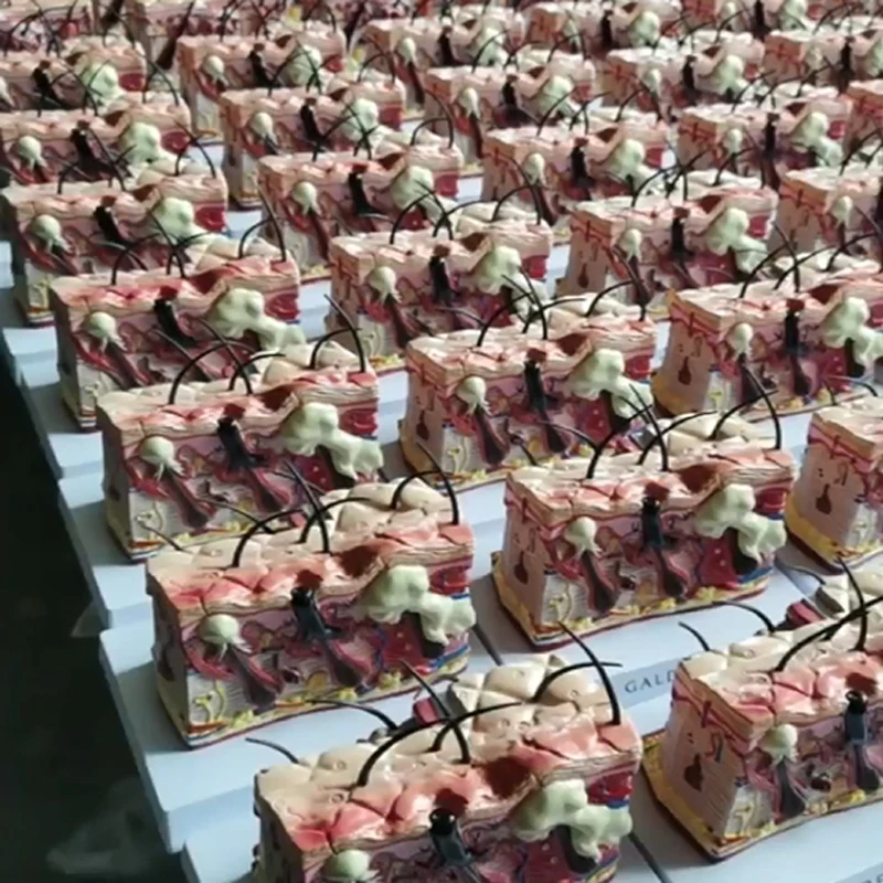 Medical science  biology  pathological skin acne anatomical  structure 3D diseased  model