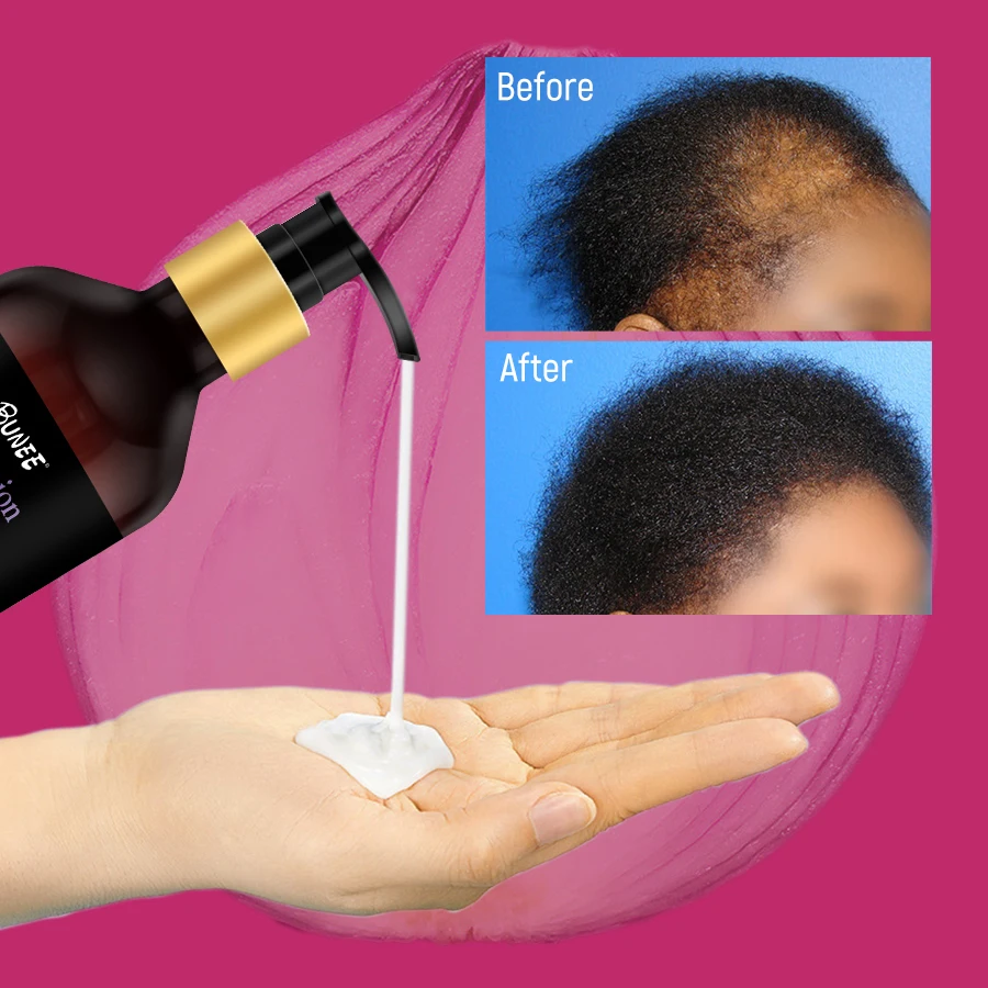Anti Hair Loss Biotin Red Onion Shampoo and Conditioner with DHT Blockers For Hair Growth