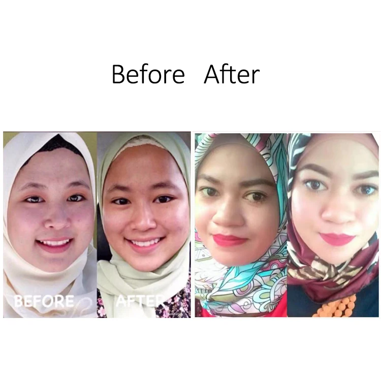 Double Chin Reducer Lifting  Wholesale Lifting Patch For Chin Upmask Mask Face