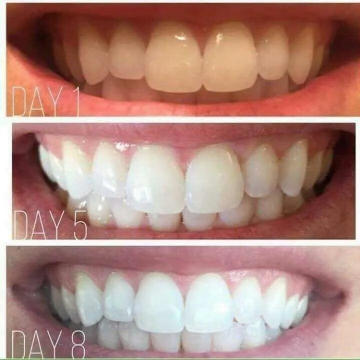 BENFITE It Is The Latest Innovation Of Toothpaste For Strong Teeth And Gum But Gentle For Your Mouth With Its SLS FREE Formula