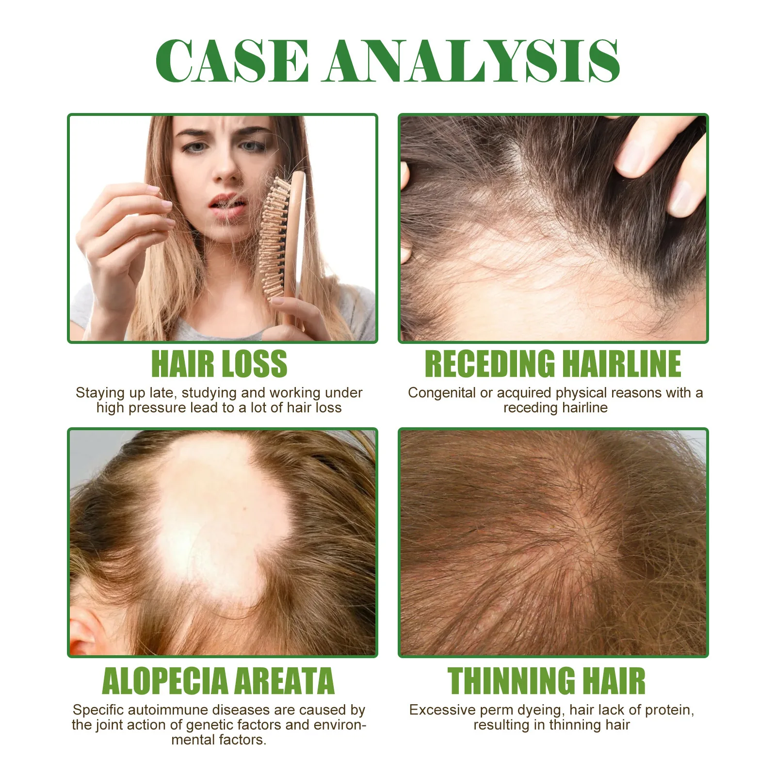 Hot Sell Rosemary Hair Care products Promote Hair Growth Nourishing Saver Relieve Scalp Tension  Mint Scalp best hair oil