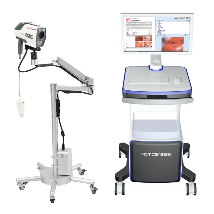 2024 Fast Delivery Medical Colposcope Equipment For Gynecology Examination
