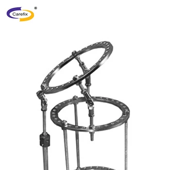 Конструкция бедренных суставов, фрагмент тазового сустава, феморальный внешний фиксатор ilizarov, внешний фиксатор