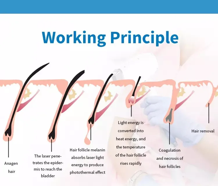 Factory price multifunction IPL machine laser hair removal longest lasting life three years warranty