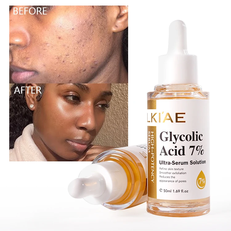 Customize  Glass Skin Care  7% Glycolic Acid Centella  Blemish Remover Pigmentation Peeling Beauty Facial Serum