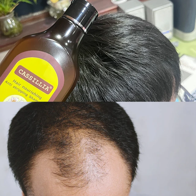 Herbal Hair Loss shampoo Treatment Growth Top Seller Organic Natural Private Label from China for Men Unisex OEM Suit Solid