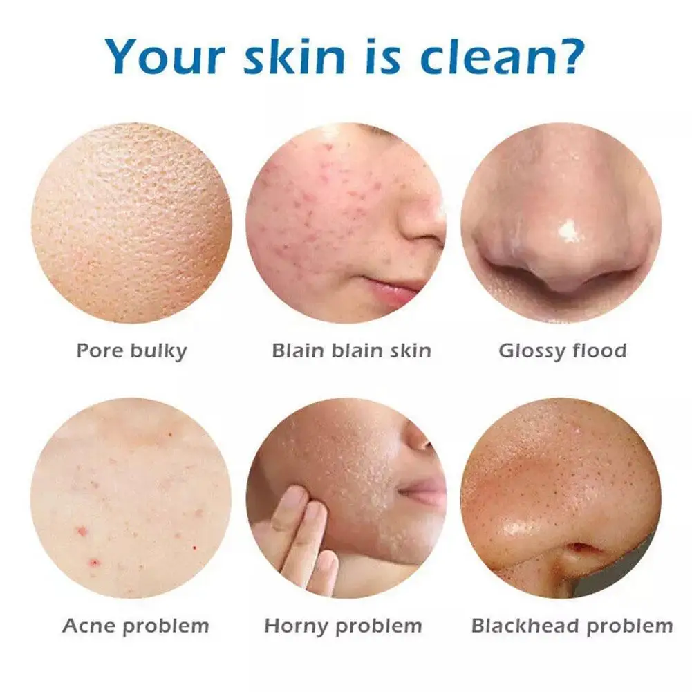 Turmeric Soap Herbal Natural Skin Body Care Deep Cleaning Oil-Control Acne Treatment Nourishing Whitening Soap