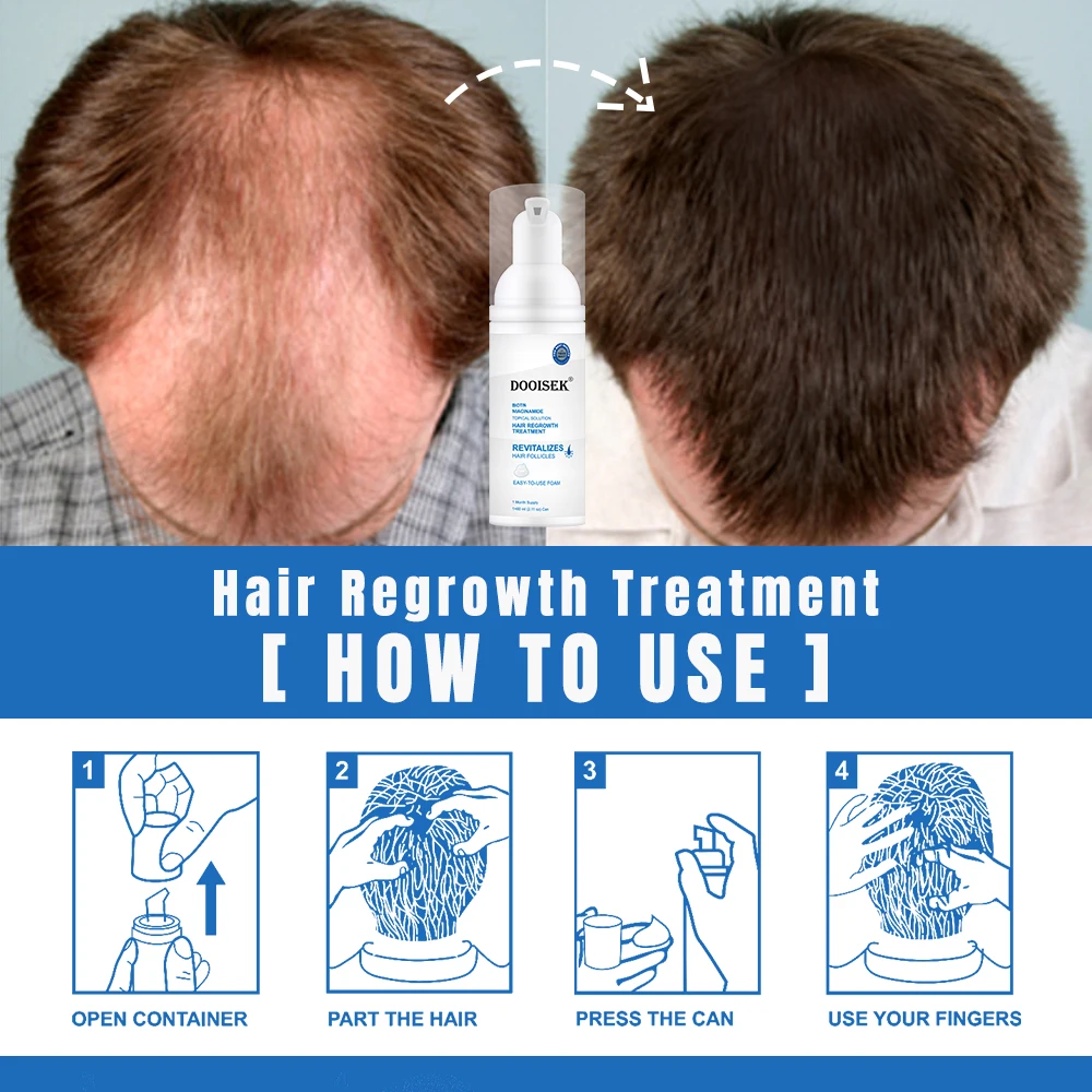 Hot Products 60ml Super Fast Hair Growth Serum Tonic 5% Hair Growth foam Anti Hair Loss Treatment