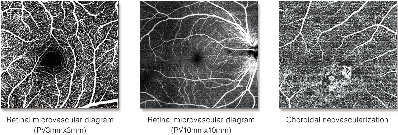 2020 Top CE approved Ophthalmic Optical Equipments for hospitals