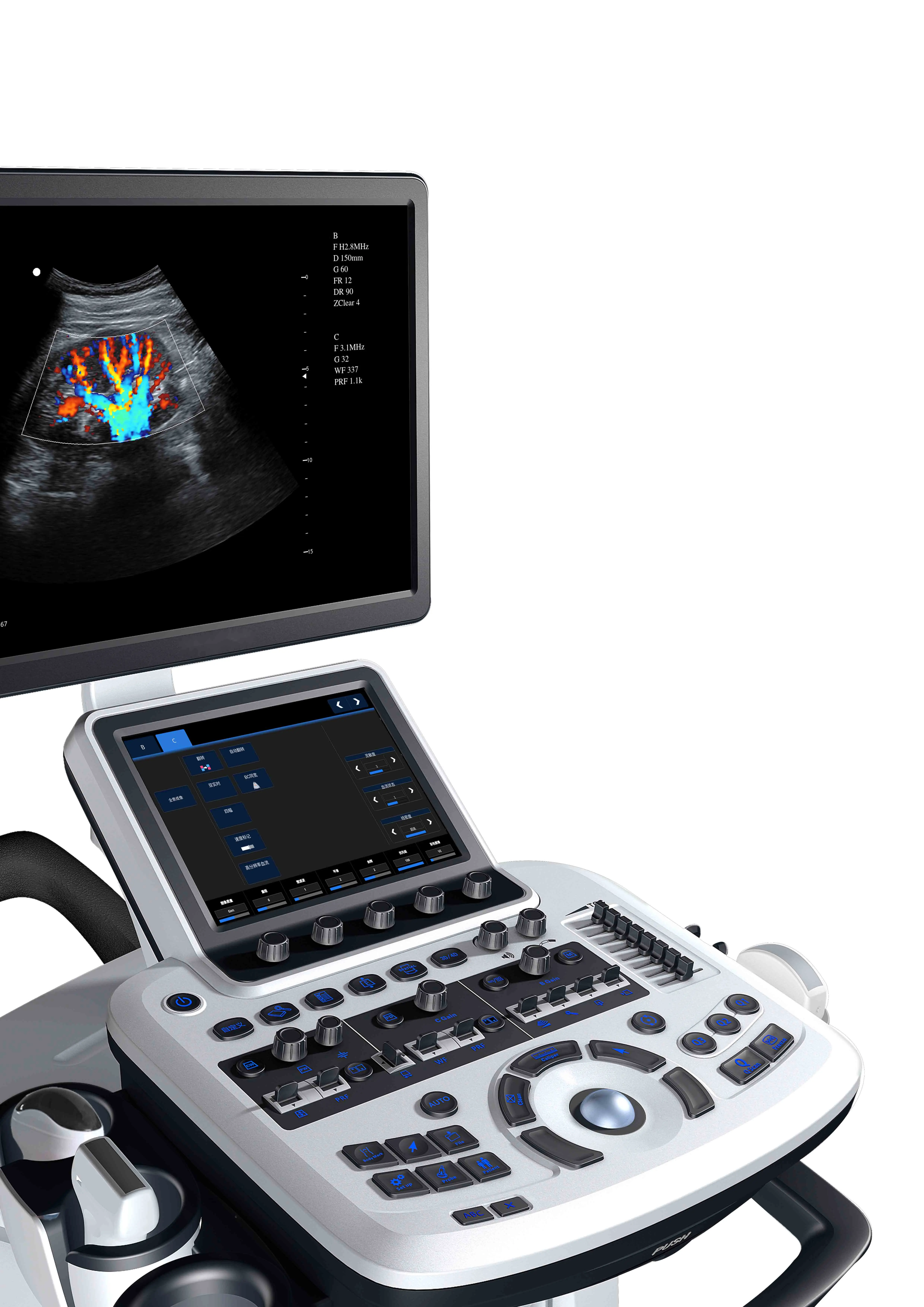 19-Inch Trolley Type Full Digital LCD Color Doppler Ultrasound Machine with 10.4 Inch Touch Screen Medical Instruments