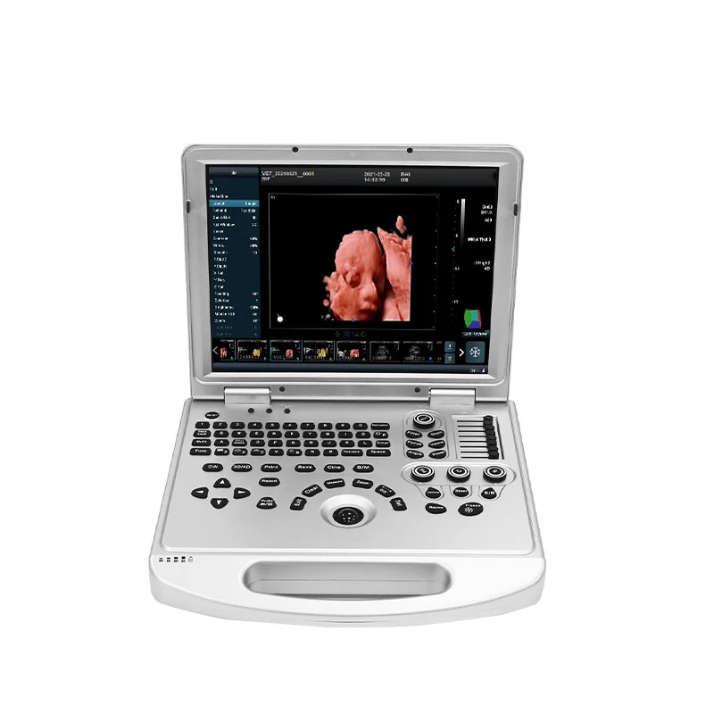 SoyMed 4D/5D ultrasound scanner color Doppler& portable ultrasound machine