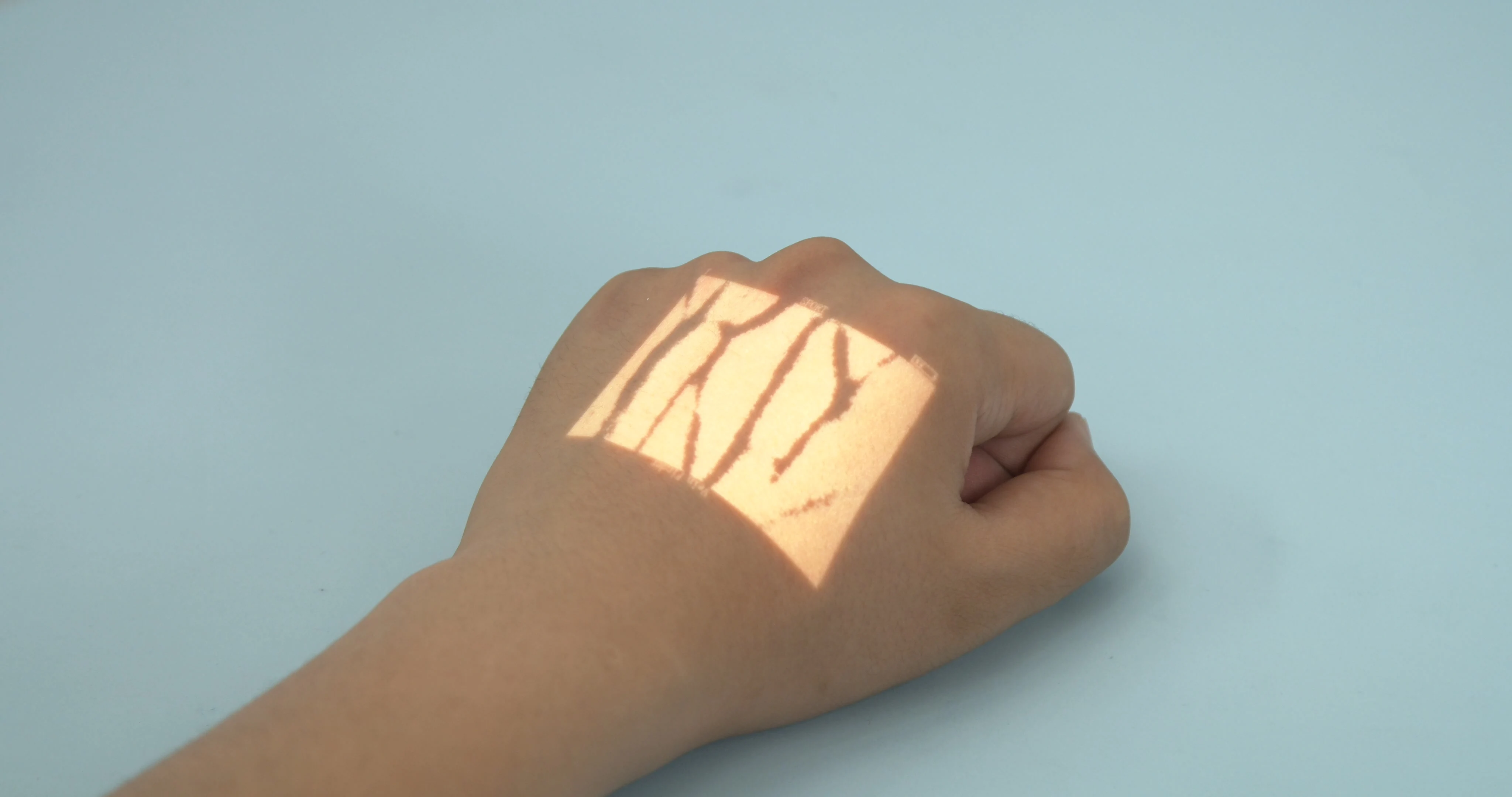 RC-VF500T  rechargeable transilluminator vein finder lamp made in china