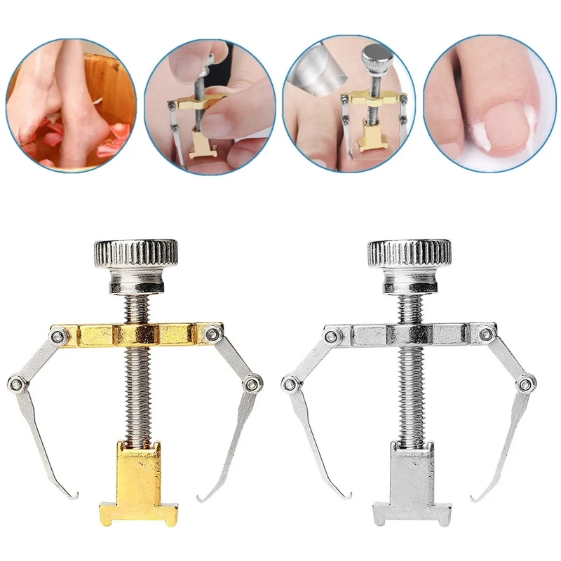Ingrown Toenail Correction Brace Kit Professional Toe Nail Care Pedicure Manicure Clipper Fixer Recover Corrector Tool