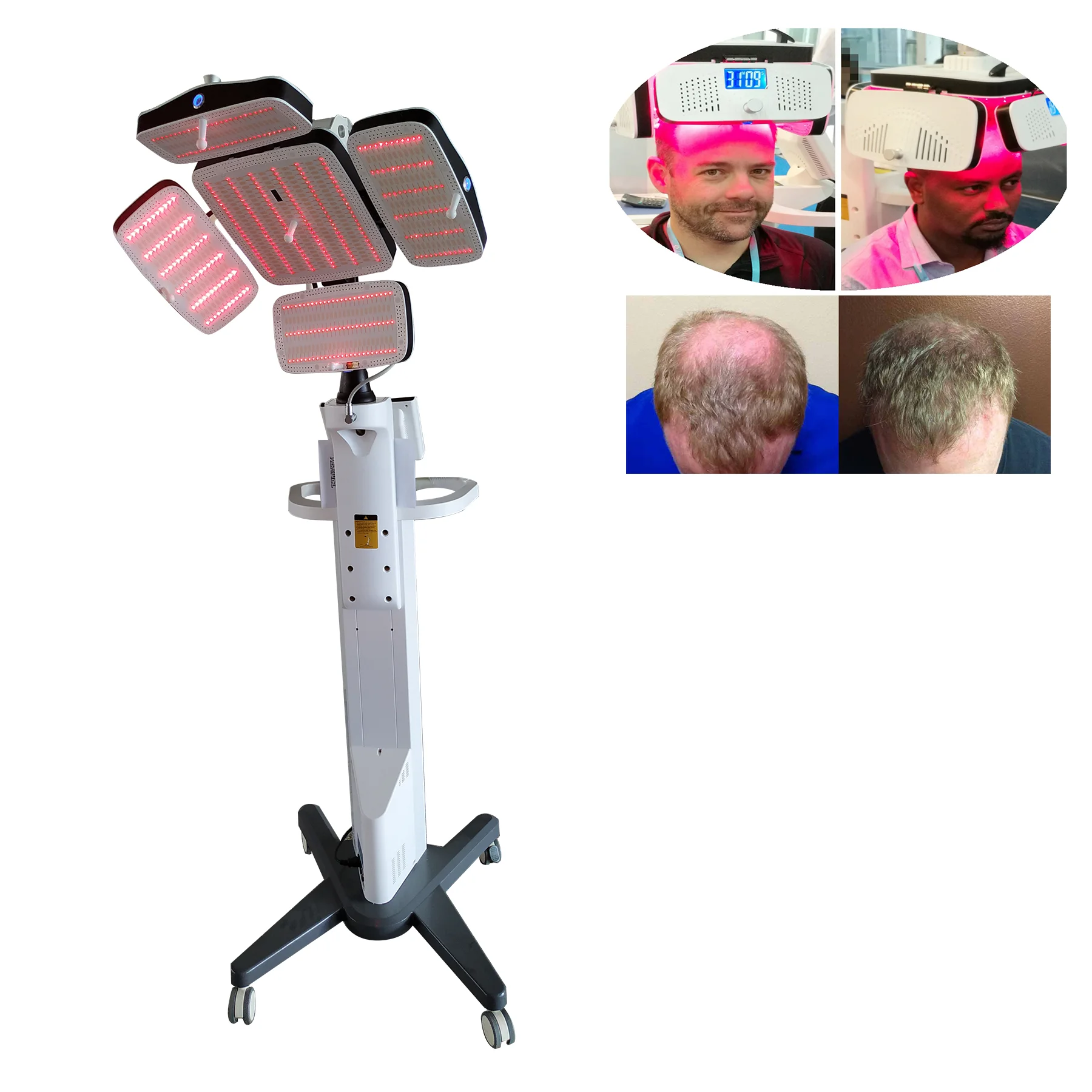 CE andFDA professional OEM price 650nm low level diode laser Stationary permanent laser machine for Hair regrowth