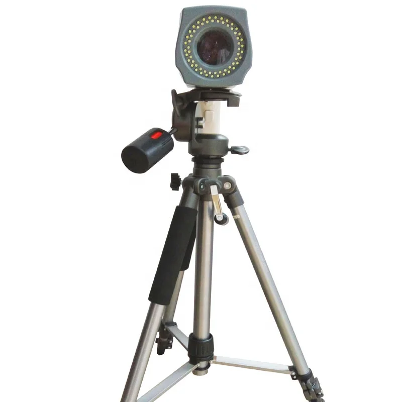 HD digital video colposcope/gyneology health colposcopy camera