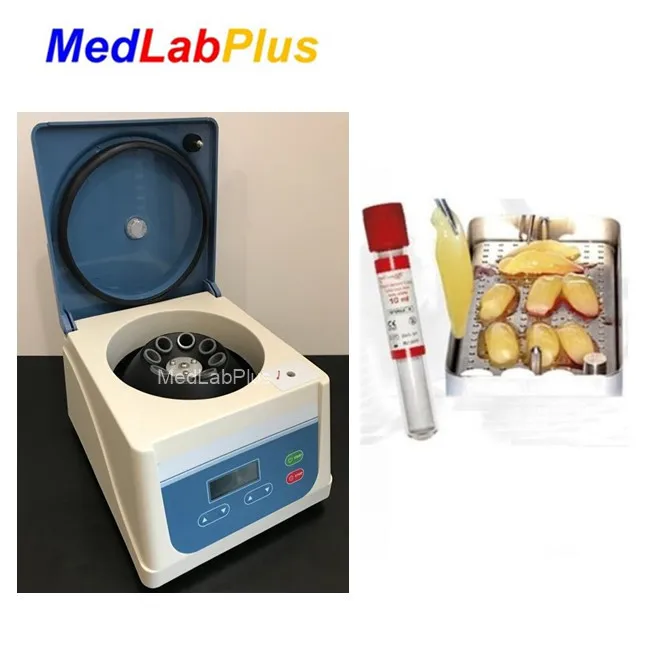 prf centrifuge dental