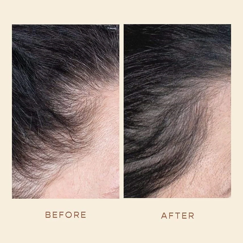 Custom Private Label Organic Rosemary Oil Biotin Hair Growth Serum Best Ginger Anti Hair Loss Serum for Hair Thickness