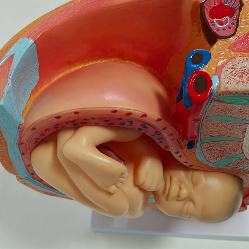 Nine-month fetal model with pregnancy in pelvis Childbirth model