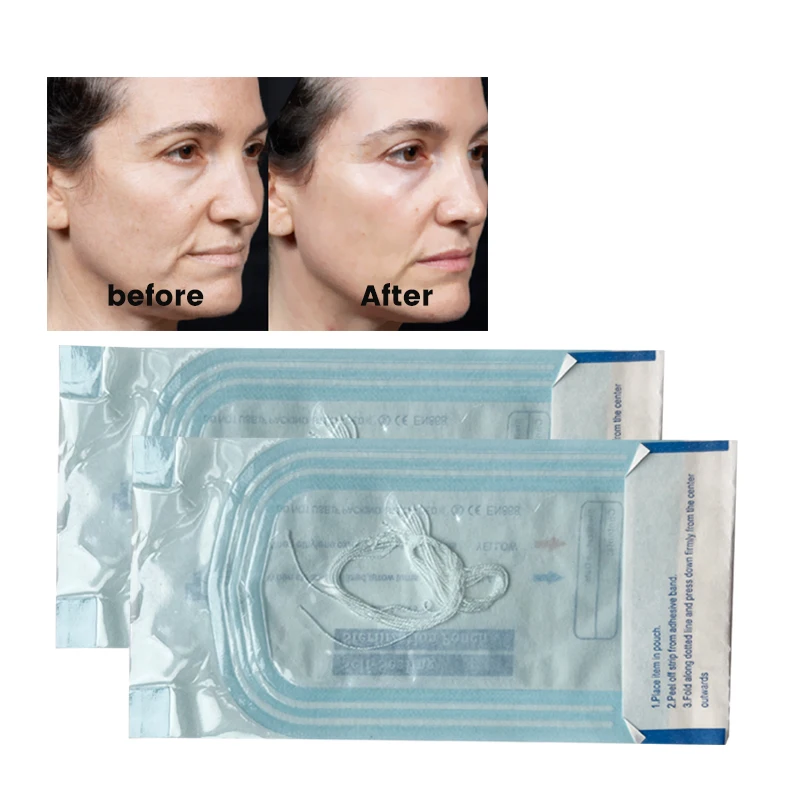 2023 most popular wrinkle remover v line  thread lift pdo nose thread lift collagen firming face