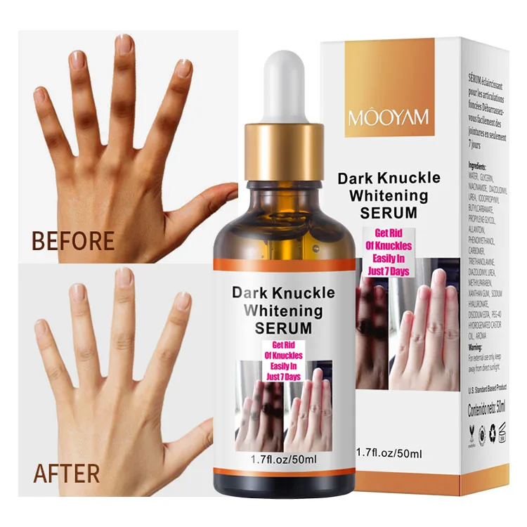 Dark Knuckles Strong Effective Whitening Serum Hand Knuckle Glow Serum for Removing Dark Knuckle Elbow and Knee