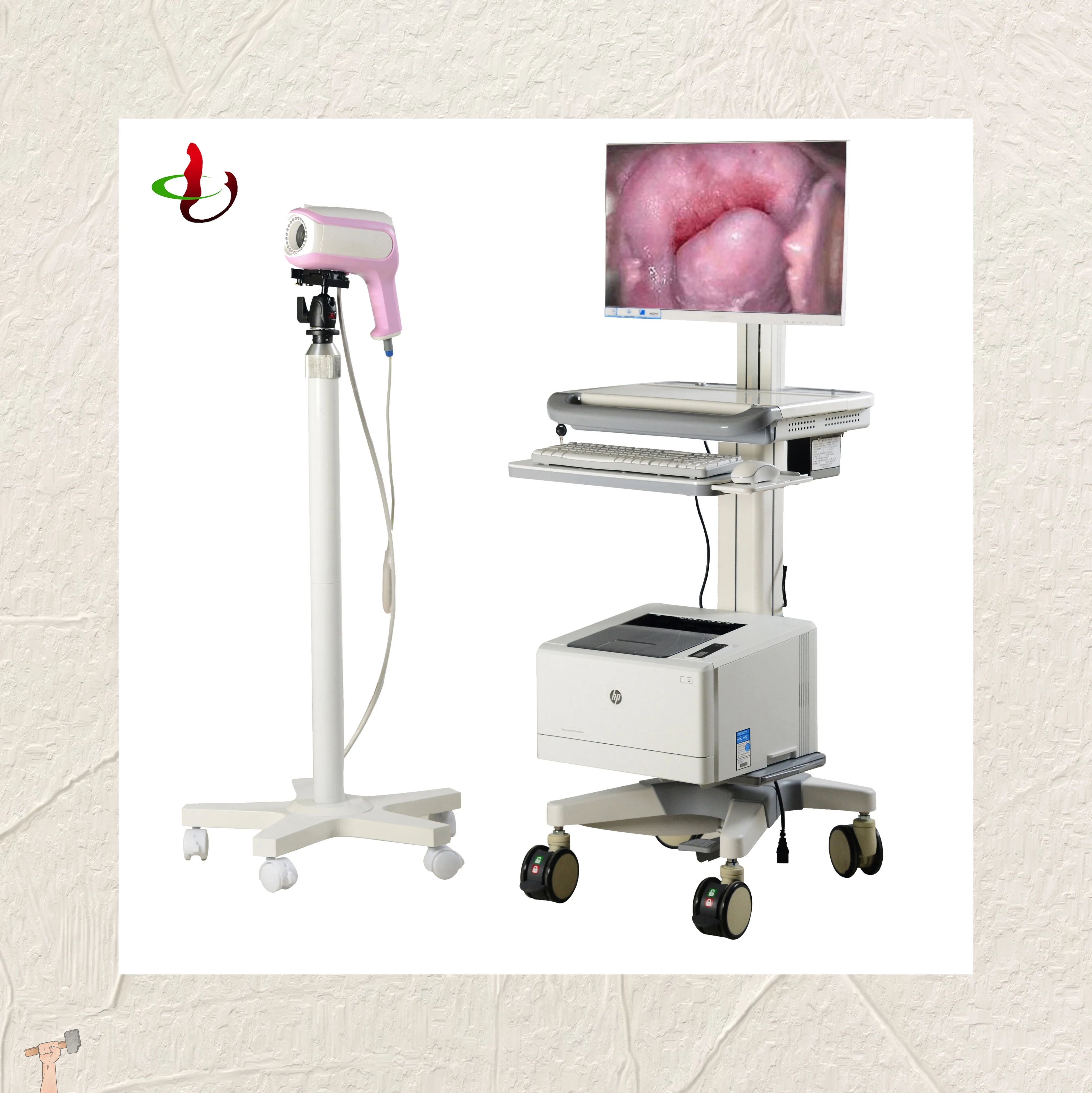 Digital Electronic Colposcope HD Colposcope video cervical electronic equipment gynecological camera video colposcope