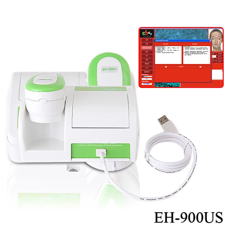 Portable 3 in 1 facial skin analyzer machine 3d oil acne pore scanner test analysis  facial skin analyzer