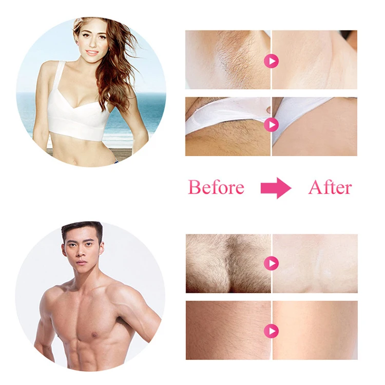 New Portable IPL Home Laser Hair Removal Mini Painless Armpit Facial Skin Body Epilator