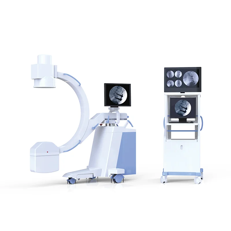 High Quality Fluoroscopy Machine digital C-arm X-ray processor imaging system machine