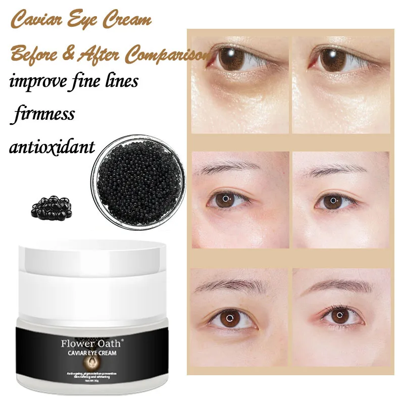 Flower Oath Removal Dark Circle Anti Wrinkle Anti Aging Caviar Firming Brightening Eye Care Wrinkle Circle And Puffiness Cream