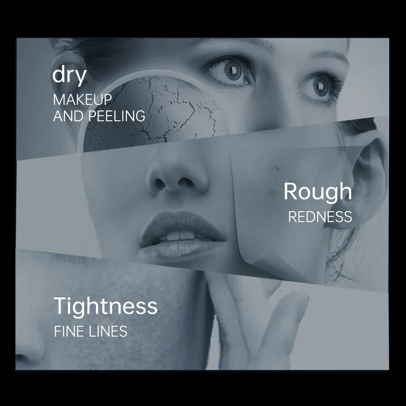 Beauty Key Anti Dark Spot Cream For Face Cream Container Primer Face Cream