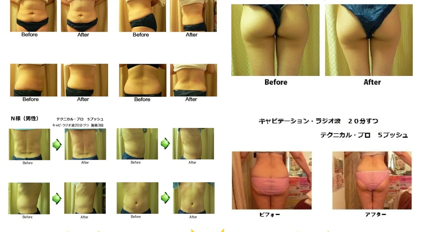 
Home easy use no side effects body fat burn cream stomach slimming 
