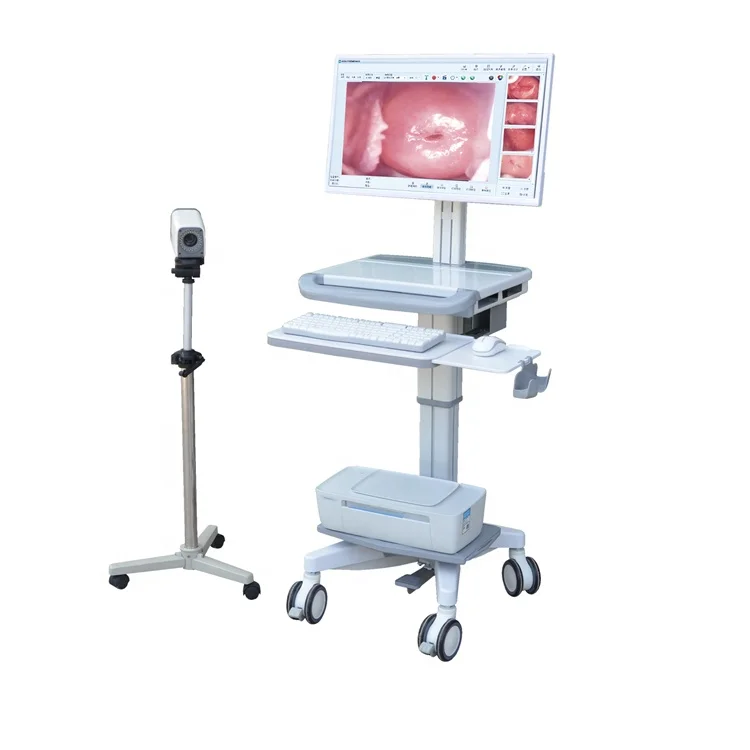 Handheld HD Video Colposcope Camera Gynecology Vagina Colposcope With 100 000 hours Life Time