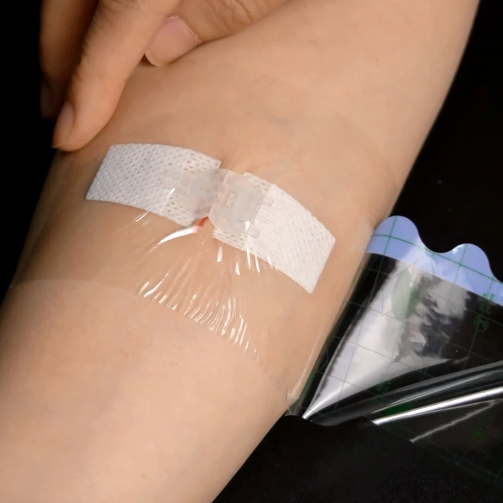 Cobalt60 Sterile reinforced medical wound skin closure strip