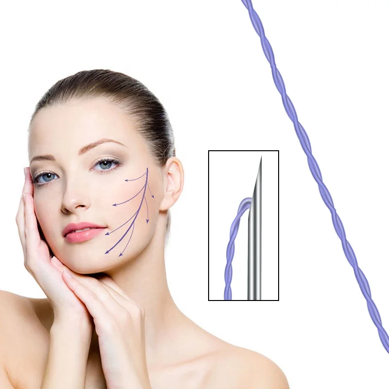 2023 skin beauty firming young suture material hot sale lasts a long time tornado tornado screw PDO thread from Korea