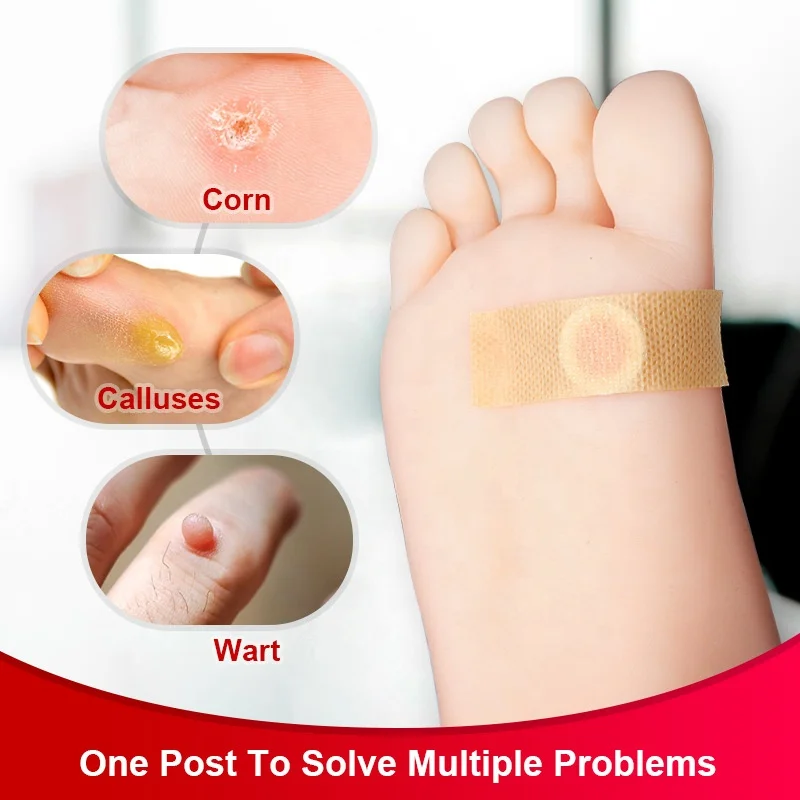 Rehabilitation treatment supplies health medical corn paste foot callus ointment