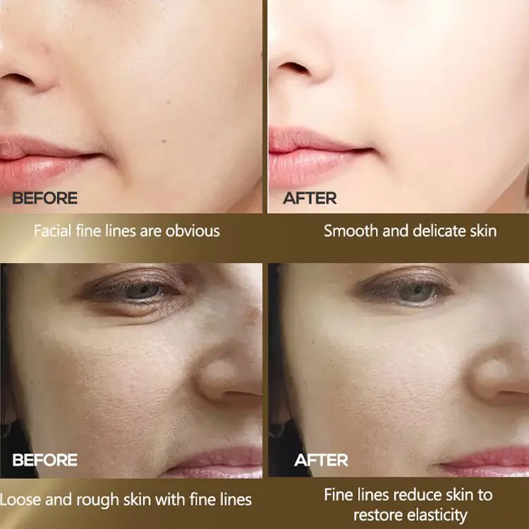 OEM ODM Privare Label Face Skin Care Kit Korea Moisturizing Whitening Anti-Aging Turmeric Skin Care Set